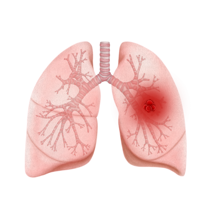 Lung Illustration (No Outline Look)