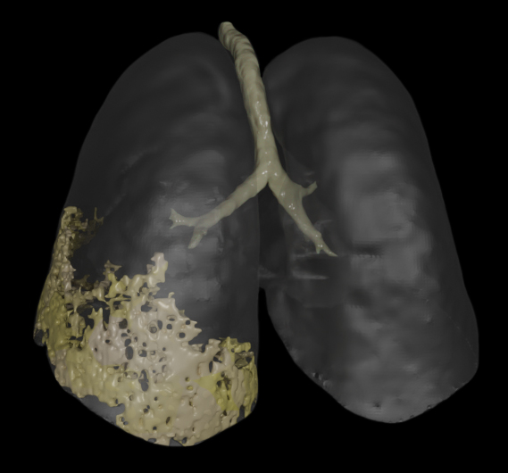 Inflammation (Black BG)