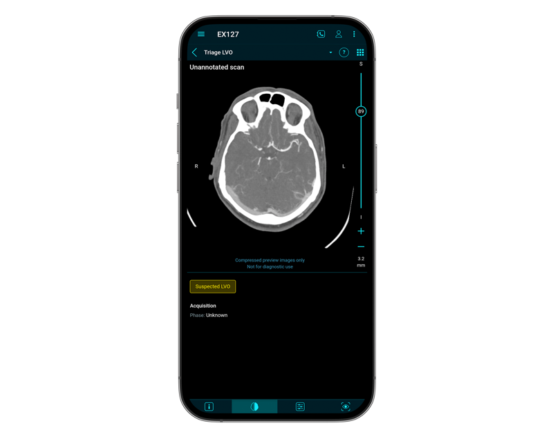 Triage Lvo Phone Only 3 1Wide