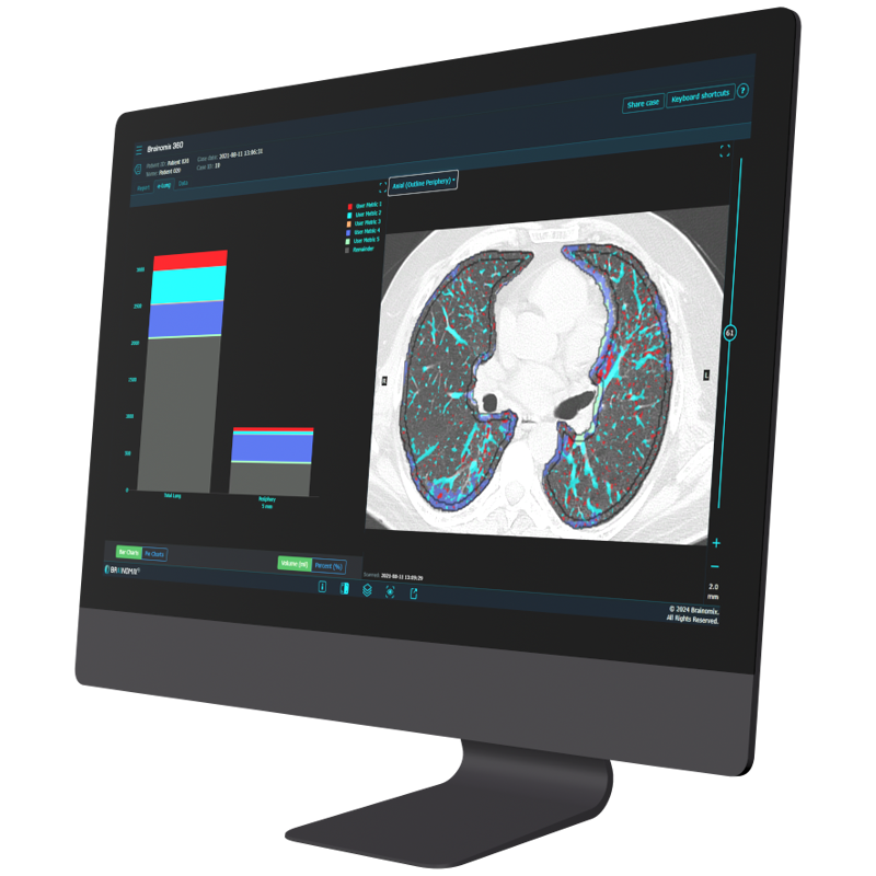 E Lung Website Image