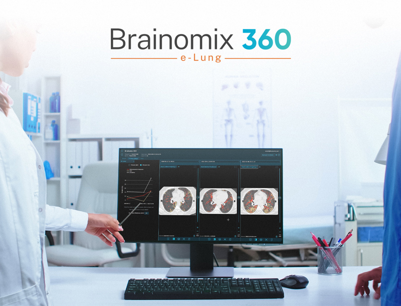 E Lung In Clinical Setting