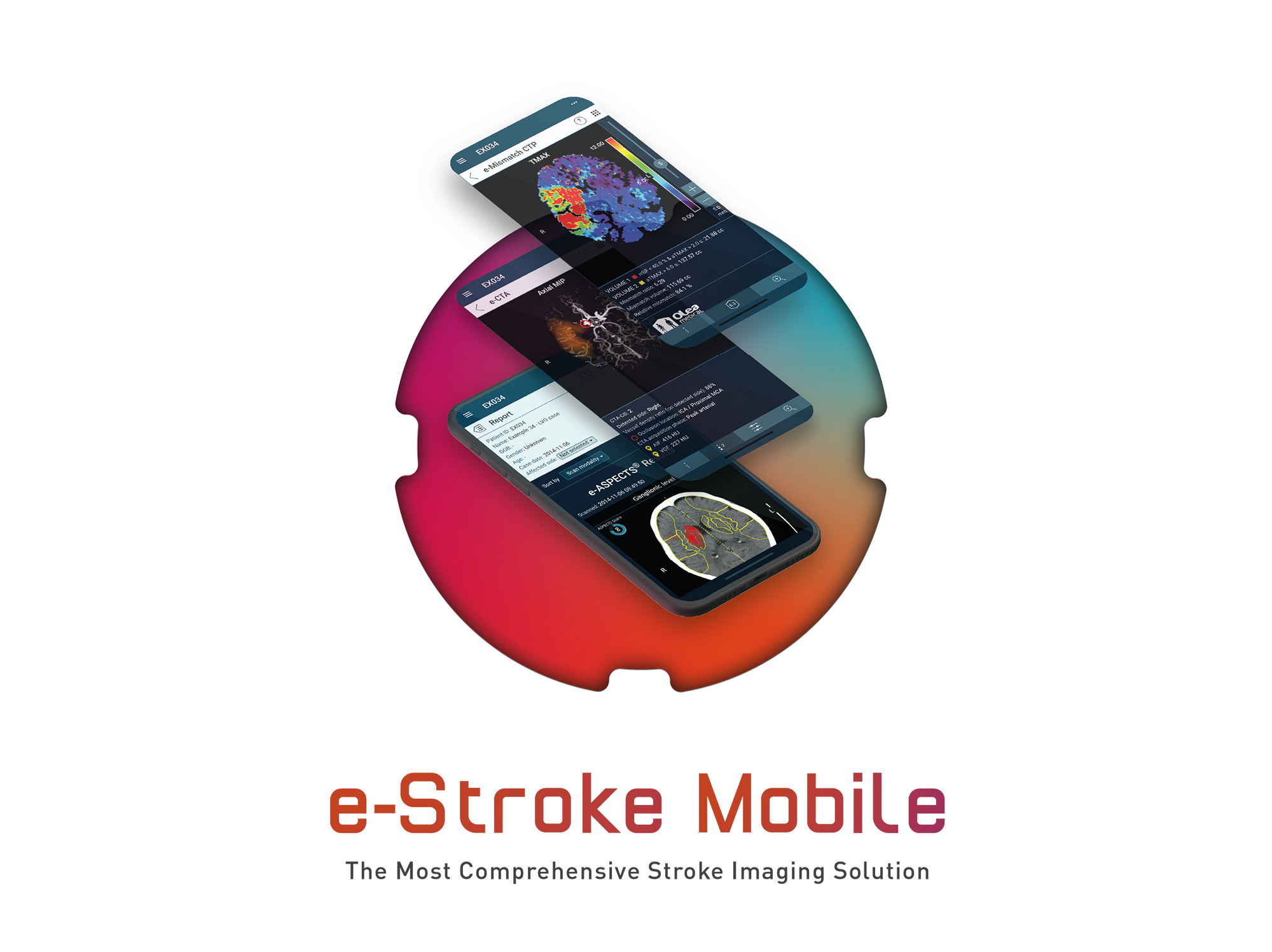 E Stroke Suite Mobile 006
