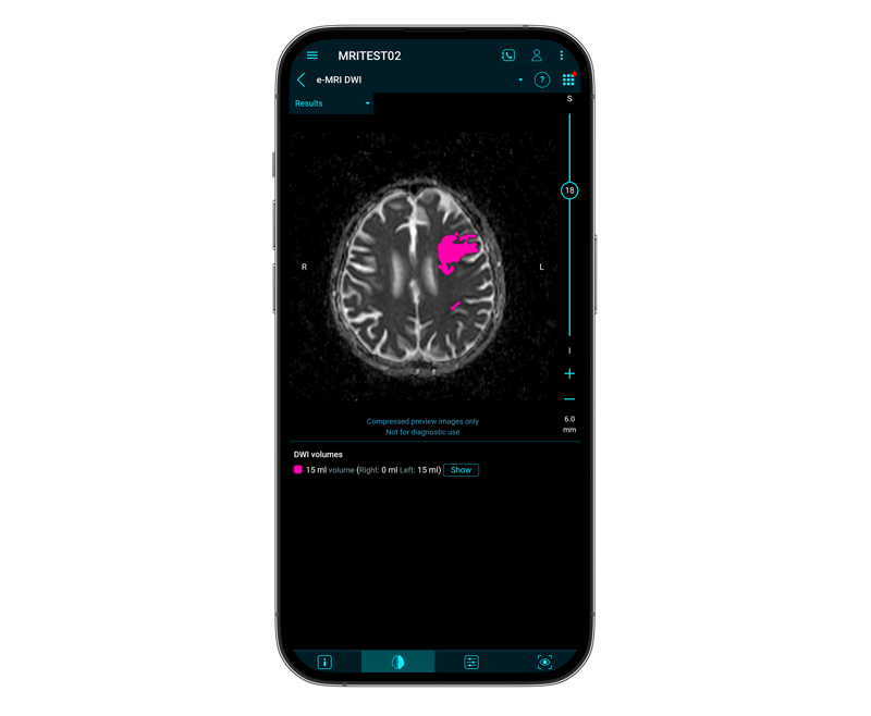 E Mri Wide