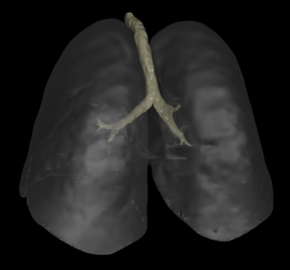 Total Lung Volume (Black BG)