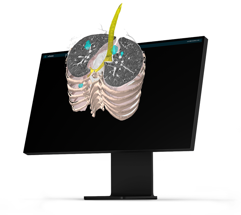 Desktop_e-Cancer_Prespective_Horizontal