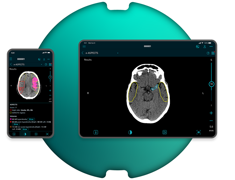 E ASPECTS Phone And Tablet Template Web